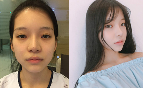 韩国灰姑娘整形外科轮廓