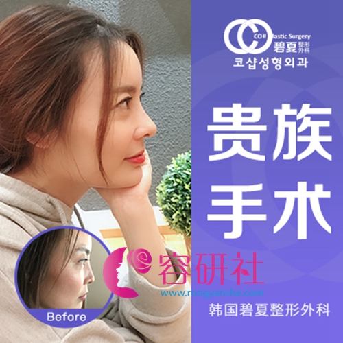 韩国碧夏整形医院自体脂肪填充额头+肋软骨隆鼻手术前后效果对比