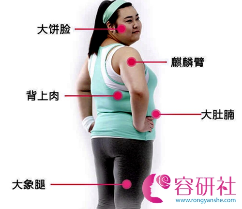 为什么韩国365MC吸脂减肥不易反弹？