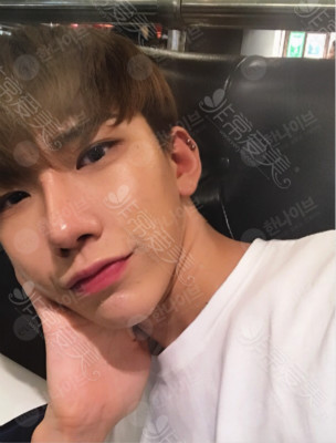 韩国男士整形好么? 韩国男士整形好么?