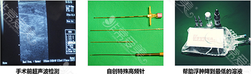 高频缩小术手术方式 高频缩小术手术方式