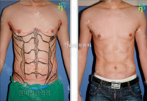男生腹肌的照片 男生腹肌的照片