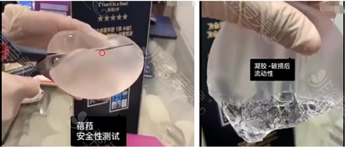 蓓菈假體實驗 蓓菈假體實驗