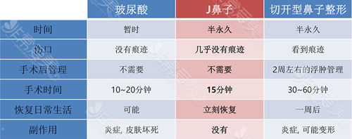 J鼻子手术优势 J鼻子手术优势