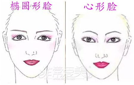 韩式小翘鼻适合哪种人图 韩式小翘鼻适合哪种人图