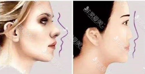 如何打造立体眉弓 如何打造立体眉弓