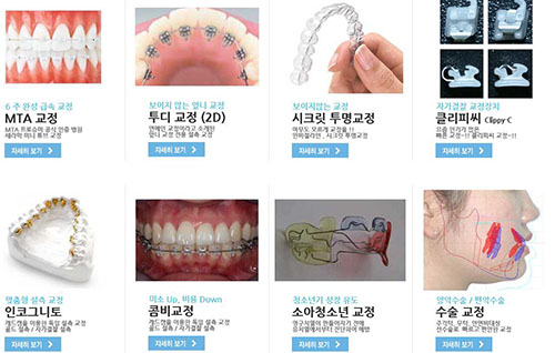 韩国iplant牙科医院优势
