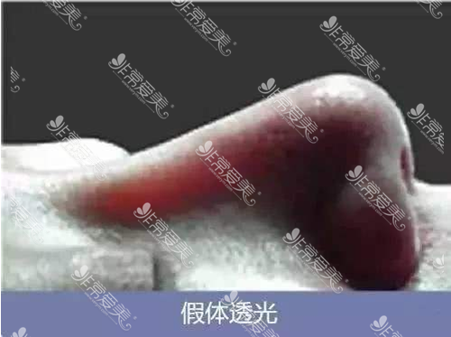 硅胶假体透光示意图 硅胶假体透光示意图