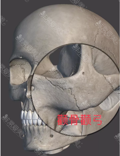 颧弓缩小手术费用是另收吗颧骨颧弓做哪里改善更大