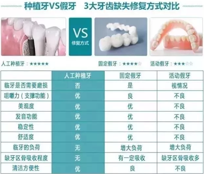 牙齿修复方式对比图