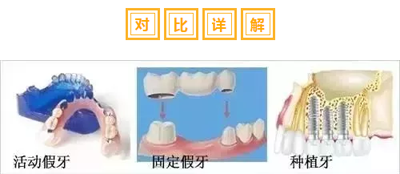 牙齿修复对比