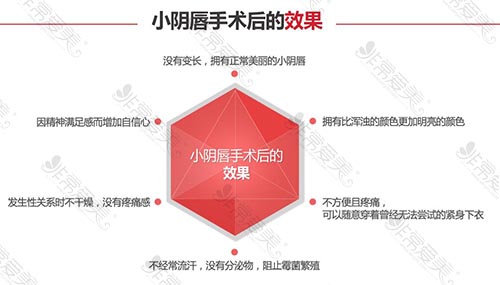 小阴唇整形术后效果 小阴唇整形术后效果