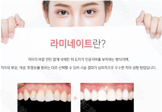 韩国雪白牙科图片