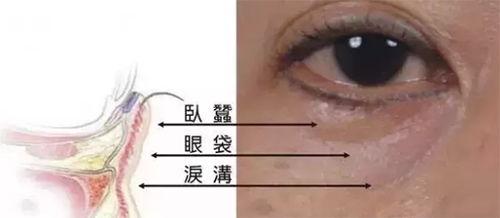 眼部结构组织图