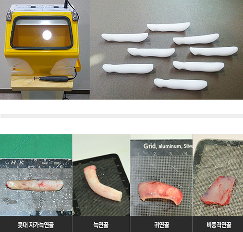 韩国Baroko医院隆鼻材料