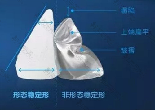 曼托和傲诺拉区别在哪里 曼托和傲诺拉区别在哪里