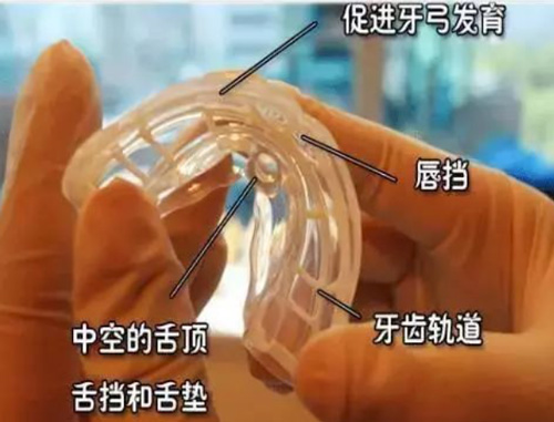儿牙干预矫正器