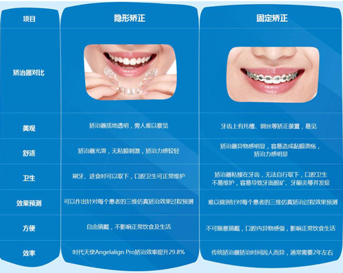 隐形矫正的特点