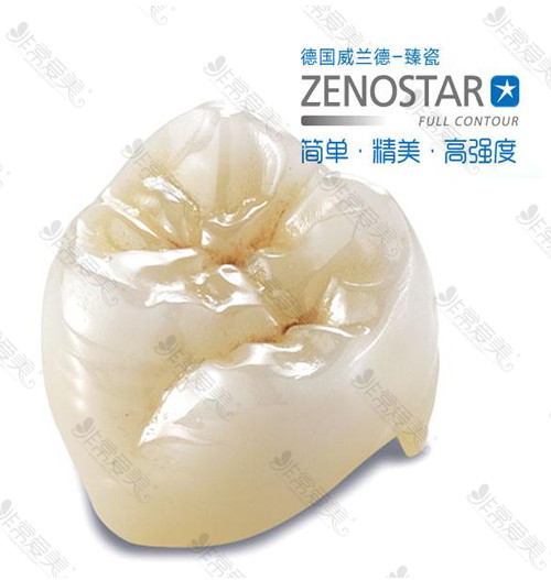 威兰德臻瓷多少一颗 威兰德臻瓷多少一颗