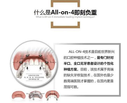 温州哪里种牙好又便宜,一般种牙多少钱一只5000块的能用吗?