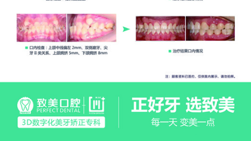 湛江致美口腔医院价目表公布,属于正规牙科医院且性价比高!