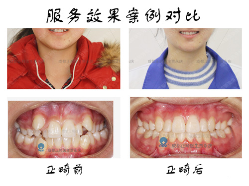 成都圣貝口腔正畸