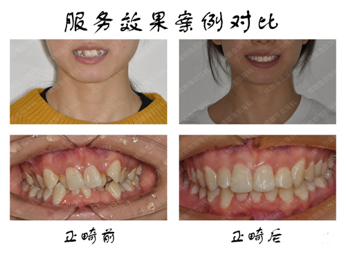 成都圣貝口腔牙齒矯正