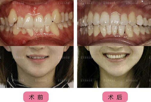 泉州牙科比较好的医院是哪家?这3家私立口腔看牙正规口碑好