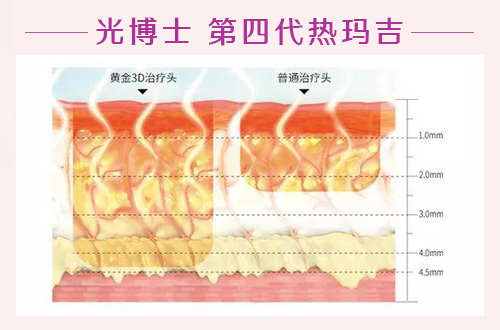 看了重庆光博士8月活动价格表,我做全脸热玛吉,感觉棒棒哒