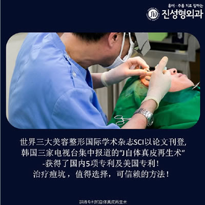 韩国陈整形外科治疗痘坑过程