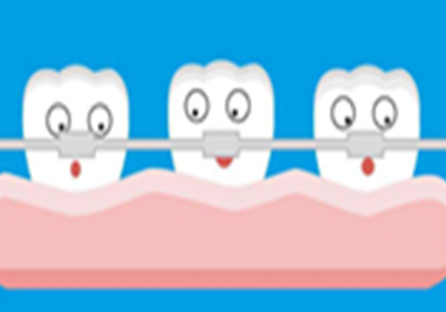 牙齿矫正步骤有人了解吗？矫正牙齿多久加紧一次？