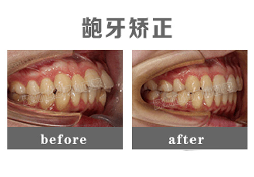 深圳牙科医院便宜又好有哪些?这些深圳正规牙科医院都不贵!