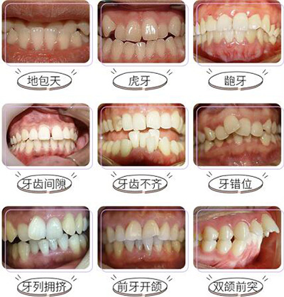 珠海爱思特口腔牙齿正畸好不好