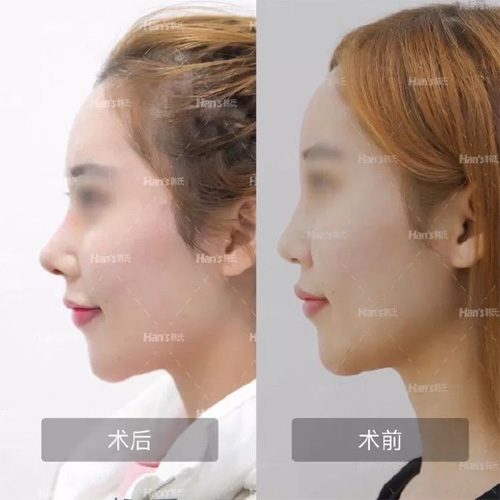 济南韩氏整形医院鼻整形<span style= 济南韩氏整形医院鼻整形<span style=