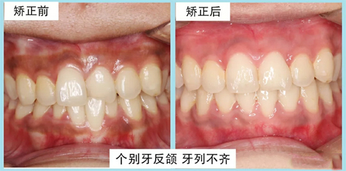 萌牙客口腔牙齿矫正