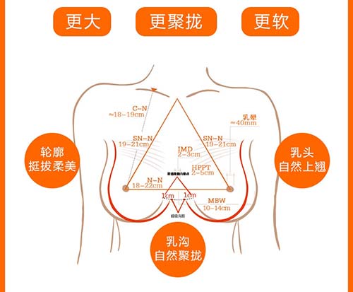 杭州妹子做曼托隆胸价格大概多少?连天美整形怎么样?