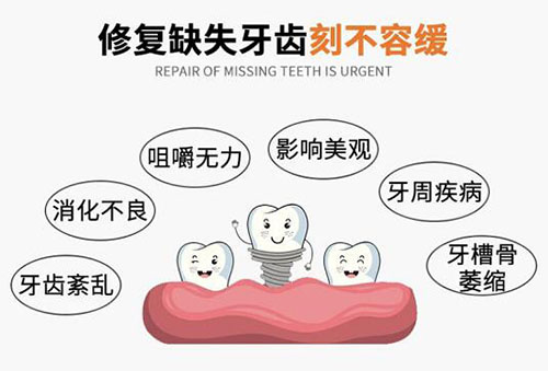 石家庄种牙多少钱一颗?中诺口腔进口植体5000起效果好价不高