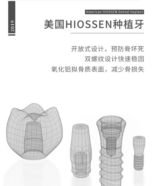 美国皓圣种植体