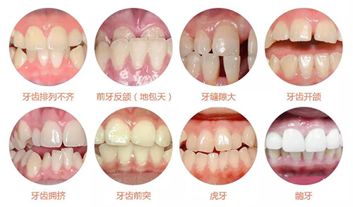 深圳牙齿正畸