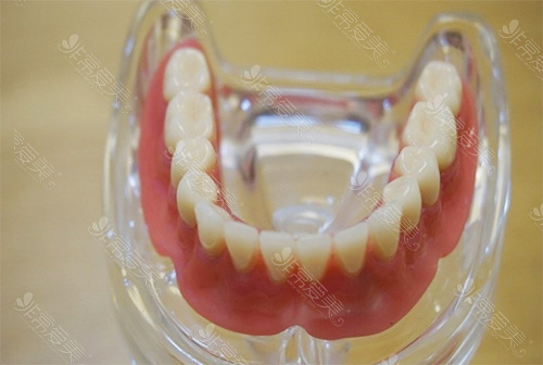 全口种植牙方法后遗症