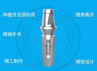 石家庄中诺口腔种植牙