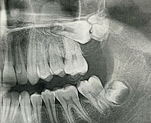 想找南#2Y*&x*b腔医院黄主任拔牙?这里不用黄牛号,约吗?