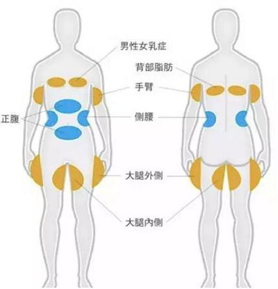 唐山苏亚美联臣减脂部位