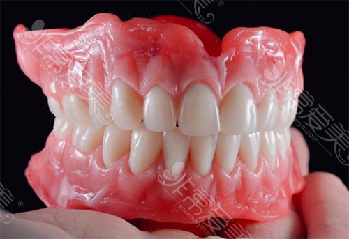 牙齿大部分缺失、全口都没牙了应该怎样镶牙更划算?