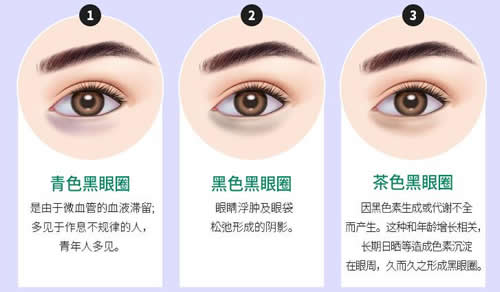 韩国麦恩整形外科熊猫针，改善黑眼圈效果明显！