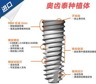 奥齿泰种植体优势分析