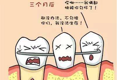 活动义齿修复牙齿缺失缺点