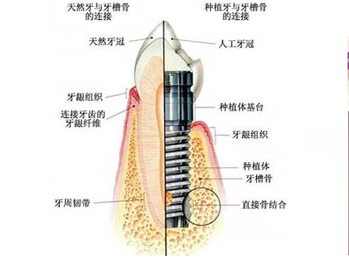 北京中诺口腔种植牙优势分析