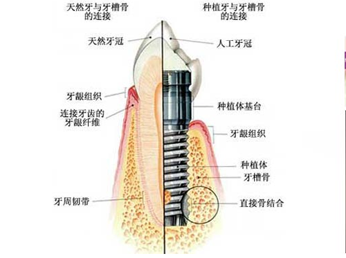 北京中諾口腔種植牙優(yōu)勢分析