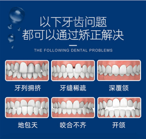 南通牙齿正畸比较好的医院有哪些